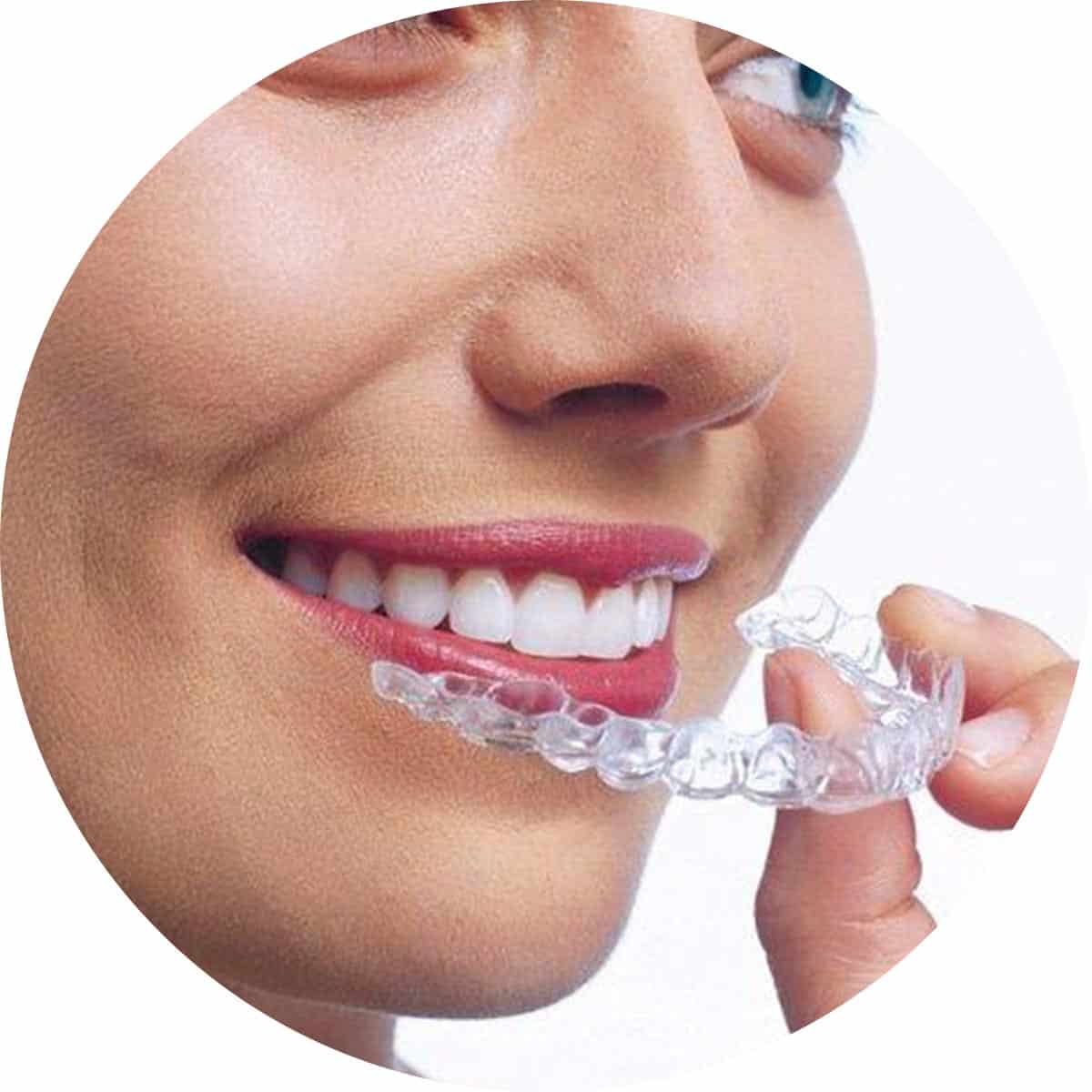 Invisalign Clear Aligner Dental Care