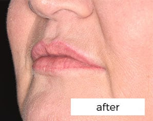 Facial Aesthetics Treatment