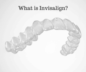 how does invisalign work