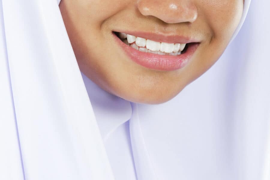 composite bonding halal preston