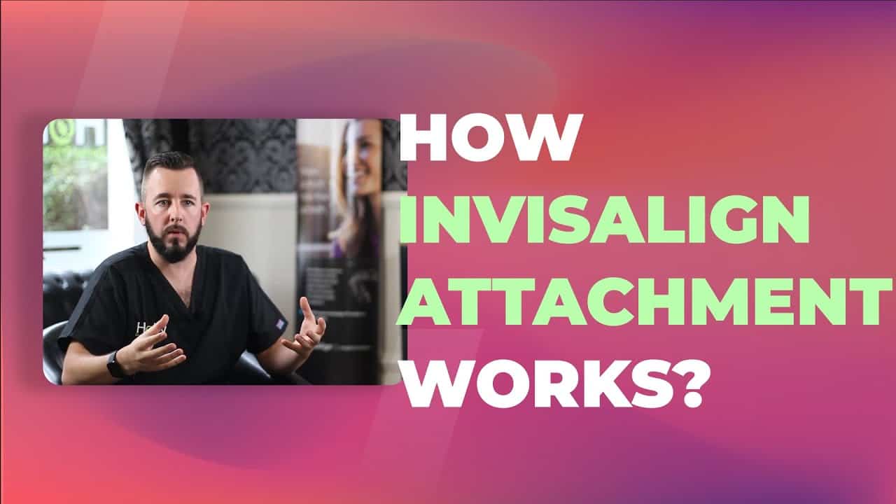 how invisalign attachments work