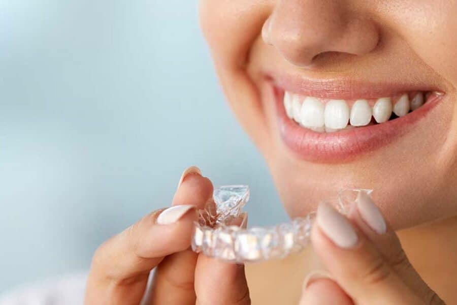 Getting Invisalign for one tooth in Preston