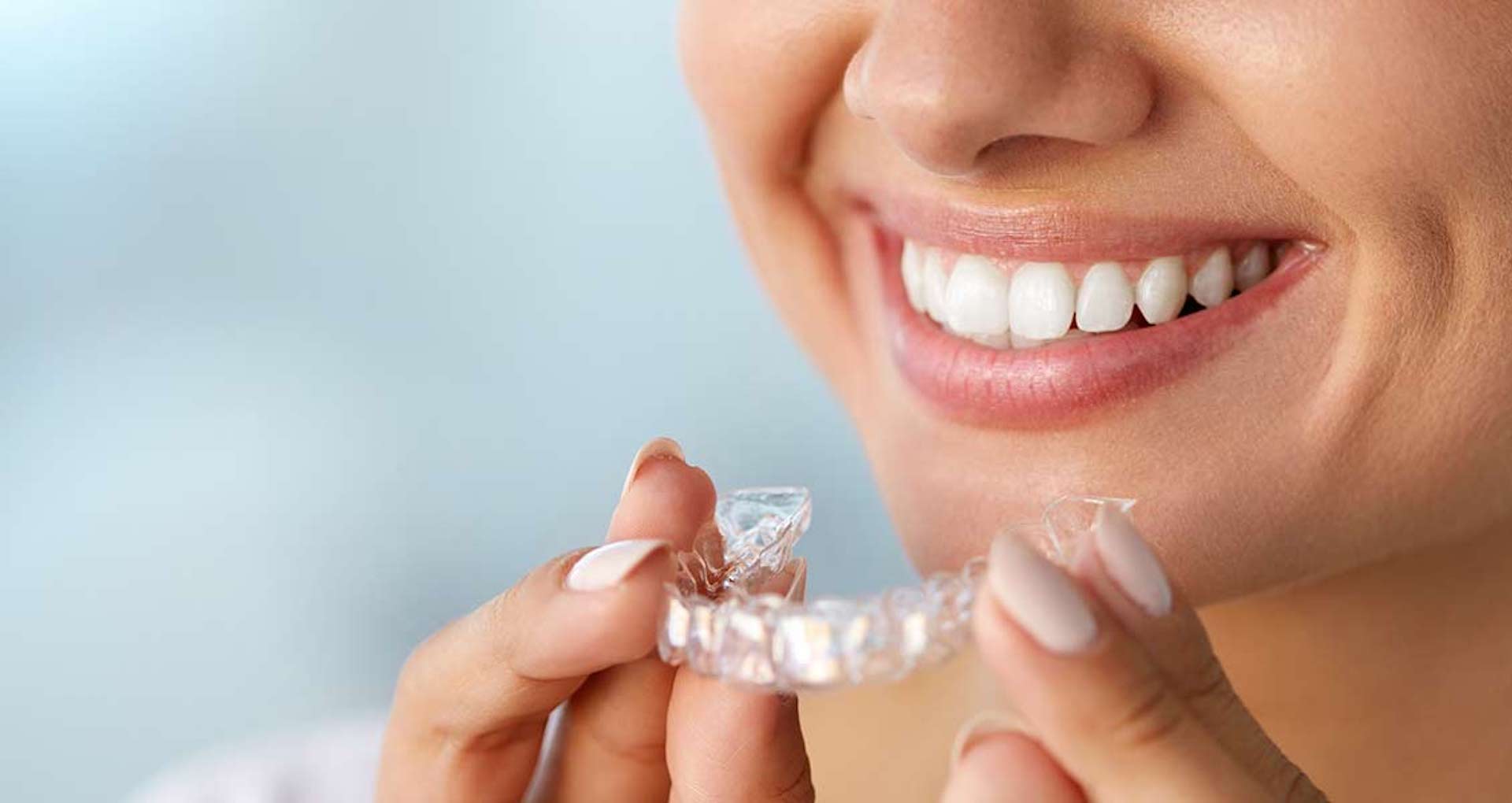 Getting Invisalign for one tooth in Preston
