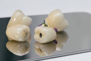 implant dentist Preston
