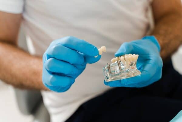 dental implants in Preston