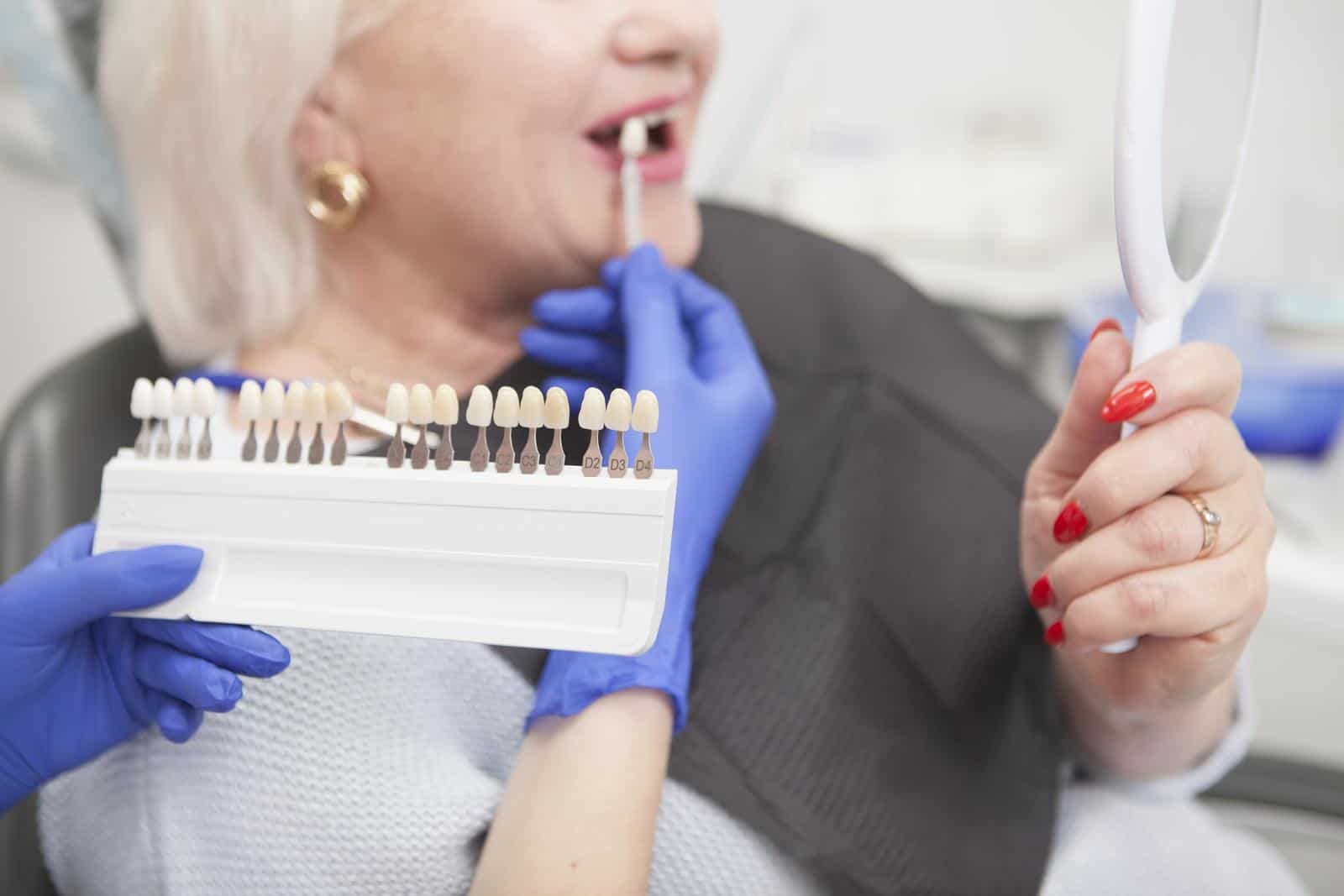 Dental implants in Preston