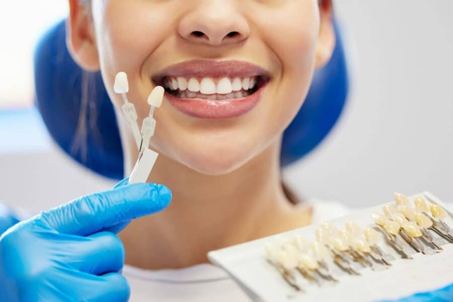 Veneers in Preston
