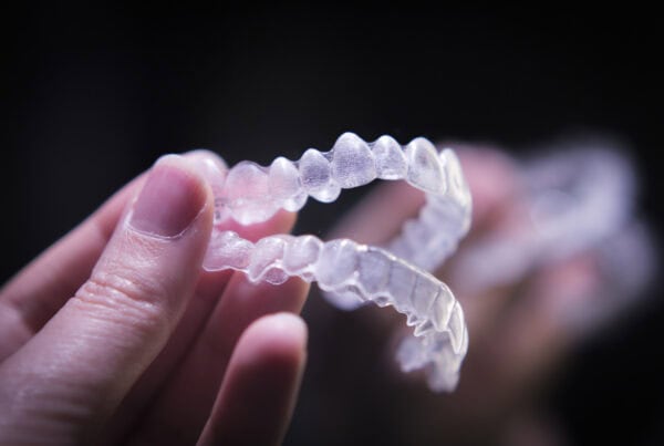 Invisalign success stories